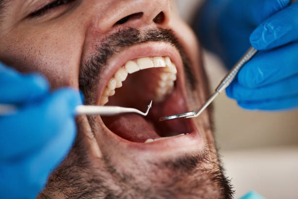 Best Dental Fillings (Composite and Amalgam)  in Demarest, NJ